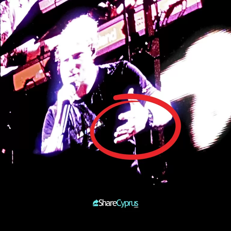 Ed Sheeran loses use of a finger on stage in Larnaca, Cyprus - 7th of September 2024